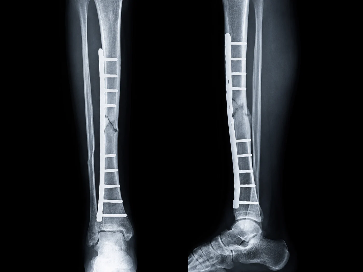 Medical imaging used to illustrate serious injury analysis